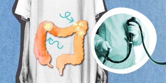 Life, Seen Through a Colonoscope