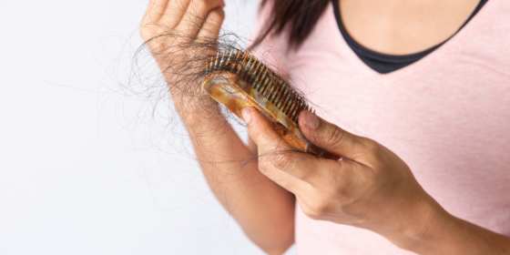 Women Experience Hair Loss Too. Here's What Can Help