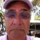 Thomas Landau, MD