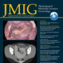 Sacral Schwannoma Mimicking a Fibroid Uterus