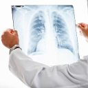 Phase 2 Trial of Haduvio for Chronic Cough Due to IPF Again Enrolling in UK