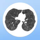 Bactrim for Idiopathic Pulmonary Fibrosis? Intriguing, but Not yet (RCT, Thorax)