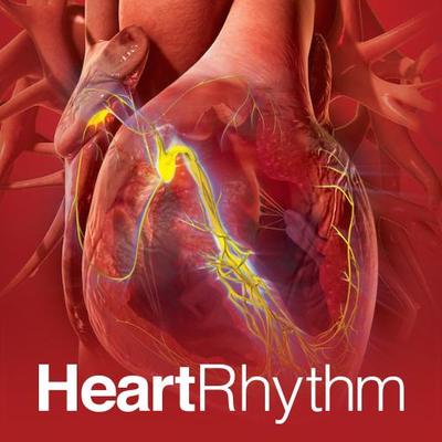 Blood Biomarkers to Detect New-Onset Atrial Fibrillation and Cardioembolism in Ischemic Stroke Patients