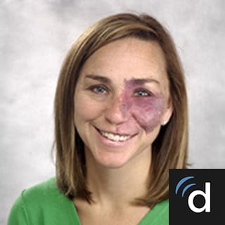 Linda Buckley, MD